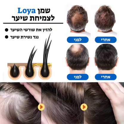 Loyaset - ראש מקלחת חכם + שמן טבעי